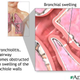 Illustration for article titled Diagnosis Pneumonia Pada Anak Pdf Download